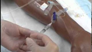 Intravenous IV Therapy Administering IV Medication via a Saline Lock [upl. by Wivina]