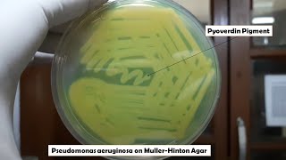 Pyoverdin Pigment of Pseudomonas aeruginosa on MullerHinton agar [upl. by Aekal]