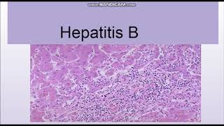 Hepatitis B Structure and Lab diagnosis [upl. by Kcirtapnaes]