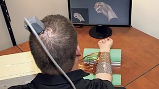 Neural bypass system restores movement in quadriplegic patient [upl. by Rabi]