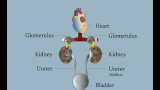 Vesicoureteral Reflux [upl. by Teddie]