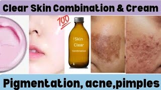 Top 2 Homeopathic medicine for clear Skin Combination amp homemade cream  glowing skin naturally [upl. by Tebor]