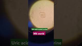 Uric acid crystal in urine [upl. by Neale724]