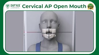 Cervical AP Open Mouth AP Cervical Spine XRay with Open Mouth What is C1 and C2 Vertebrae [upl. by Llerrah332]