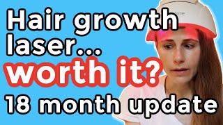 iRestore hair growth laser 18 month update Is it worth it Dr Dray [upl. by Auqinahc]