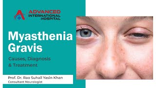 Myasthenia Gravis Causes Diagnosis amp Treatment by Prof Dr Rao Suhail Consultant Neurologist [upl. by Phillida]