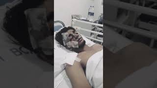 Steve Joseph accident video steeve Joseph nice 😘mixed video❣ shorts [upl. by Aihtekal]