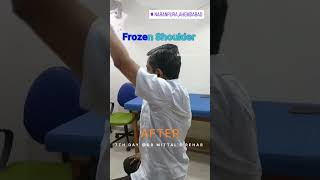 Advance Physiotherapy and Rehabilitation Shockwave Therapy 919913136662 [upl. by Ulysses]