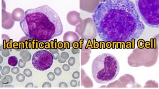 Identification Of Abnormal Cell Part 2  Identification with Real image  Myeloblast  myelocyte [upl. by Nyvlem137]