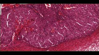 Histology of the Corpus Luteum 4K [upl. by Eseret692]