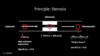 Doppler Ultrasound Part 1  Principles w focus on Spectral Waveforms [upl. by Yenahpets317]