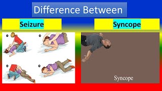 Difference Between Seizure and Syncope [upl. by Nilecoj]