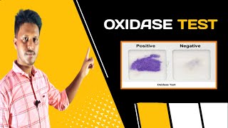 Oxidase Test AZ  in Bangla video [upl. by Eerb]