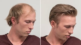 Medium Length Haircut For Men  Transformation with Hairsystem  Hairsystems Heydecke [upl. by Olvan]