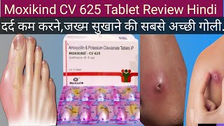 Moxikind cv 625 Tablet ke Fayde Moxikind cv 625 Tablet Uses in Hindi Antibiotics Tablet [upl. by Nari56]