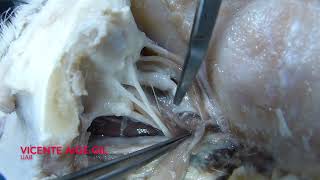 The Horners syndrome Neuroanatomy of the dog  Lesson 18 [upl. by Ahsatsan]