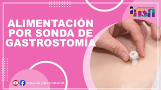 Alimentación por Sonda de Gastrostomía  Telecapacitación INSN [upl. by Kcinnay]