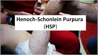 HenochSchonlein Purpura HSP [upl. by Lapo]