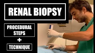 Renal biopsy procedure under CT guidance procedural steps and technique [upl. by Kreg]