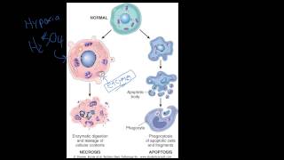 4  Introduction to Pathology  Necrosis vs Apoptosis [upl. by Lucita]