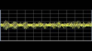 Ulcers General  Rife Frequencies [upl. by Becker]