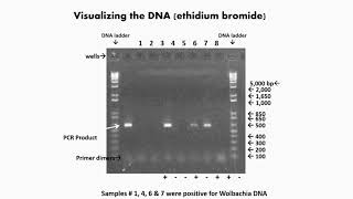 Visualization of Gel Electrophoresis [upl. by Catharine]