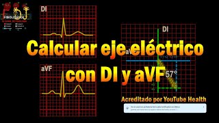 Electrocardiograma interpretación  ¿Como calcular el eje eléctrico utilizando DI y aVF [upl. by Harris]