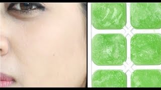 Hindi Video DIY  Aloe Vera Ice Cubes For Summer Skin Care [upl. by Booth]