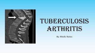 Ortho Tuberculosis arthritis  TB in joints spine TB gibbus deformity investigation treatment [upl. by Enaled]