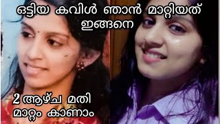 കവിൾ വണ്ണം കൂട്ടാൻ ഡോക്ടർ പറഞ്ഞു തന്ന വഴിlRamyasujayI How to Get Chubby Cheeks with out Excercise [upl. by Thane]