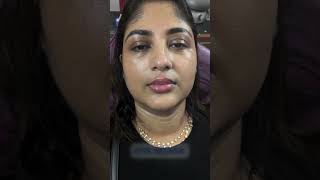 Best Eyebrow Treatment  PMU  Lip Filler Treatment  Kolkata  youtubeshorts youtubereels [upl. by Scheer]