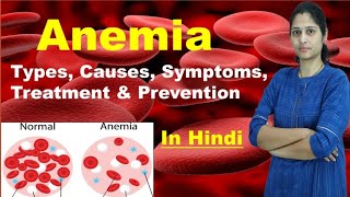 Anemia  Types of Anemia  Causes Symptoms Treatment Prevention Risk Factors  In Hindi [upl. by Nylra]