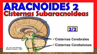 🥇 ARACNOIDES 22  Cisternas Subaracnoideas ¡Explicación Sencilla [upl. by Aisel]