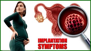 Implantation Symptoms – Top 7 Early Signs and Symptoms of Implantation [upl. by Dnalyaw]