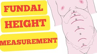 Return Demonstration  Measuring Fundal Height Leopolds Maneuver and Monitoring Fetal Heart Tone [upl. by Vani]