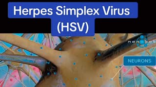 Herpes Simplex Virus HSV  3D Animation [upl. by Ennovyahs]