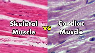 Differentiating Skeletal Muscle and Cardiac Muscle  Striations vs Intercalated Discs [upl. by Neveda]