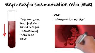 Erythrocyte Sedimentation Rate ESR what does the ESR tell you Simply Explained [upl. by Godspeed]