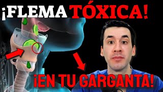 FLEMA TÓXICA en TU GARGANTA ¡ELIMÍNALA INMEDIATAMENTE [upl. by Reinhard]