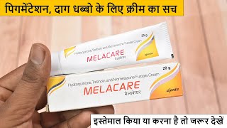 Melacare Cream Review in Hindi  100 Honest  Dark Spots Pigmentation Cream [upl. by Isabea]