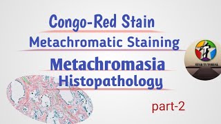 CongoRed Stain For Amyloid ll Metachromatic staining ll Histology [upl. by Poppy]