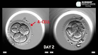 IVF timelapse imaging  Sunway Fertility Centre [upl. by Holland]