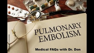 Medical FAQs Pulmonary Embolism Facts and Prevention [upl. by Pyle]