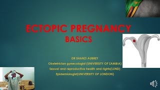 ECTOPIC PREGNANCY DIAGNOSIS AND MANAGEMENT BASICS [upl. by Enrika]