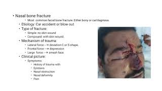 Choanal Atresia Oroantral Festula CSF Rhinorrhea Septal Hematoma Septal Abscess د ناصر العزيب [upl. by Allecnirp]