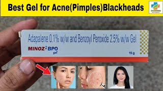 Minoz BPO Gel Use in Hindi  Minoz BPO Gel Benefits Side effects  Acne  Blackheads  SK Medicine [upl. by Zedekiah354]