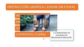 Evaluación clínica de edema [upl. by Lehcin170]