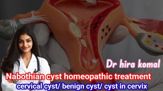 Nabothian cyst homeopathic treatment [upl. by Helena]