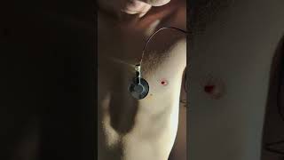 My visible heartbeat  sound🫀Full vid in description boy heart visible heartbeat skinny chest [upl. by Hcib99]