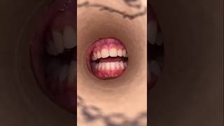 How To Tell If YOU Have Herpes 😬🦷 [upl. by Rehoptsirhc]